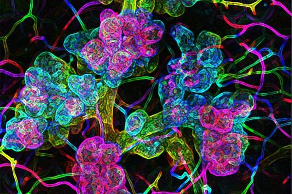 BioArtography "Milk Shake"