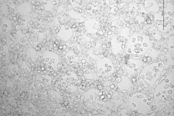 Numerous translucent cells clustered and dispersed in a microscopic view against a light background, with a 200 µm scale.